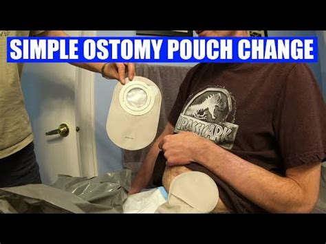 how to reverse a colostomy bag